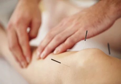 Hoe werkt acupunctuur