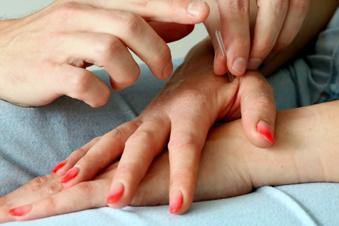 Acupunctuur en veiligheid