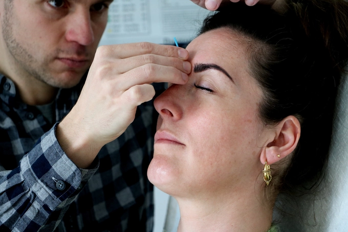 Acupunctuur bij pijnbestrijding 