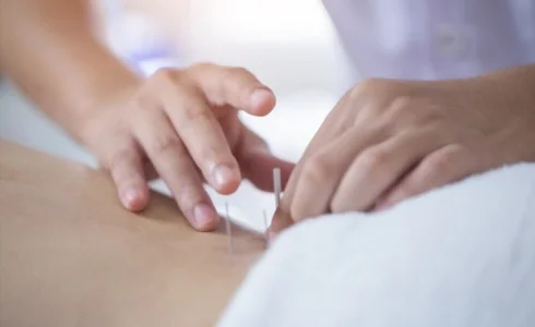 Acupunctuur en veiligheid