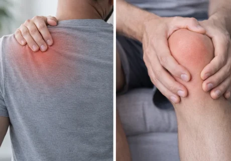 Acupunctuur – Spier-, Pees- en Gewrichtsklachten