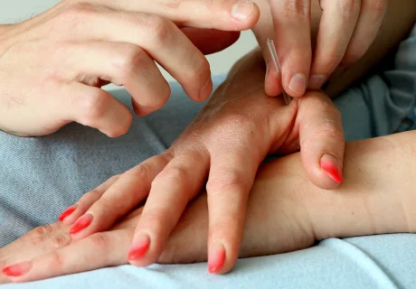 Acupunctuur en veiligheid